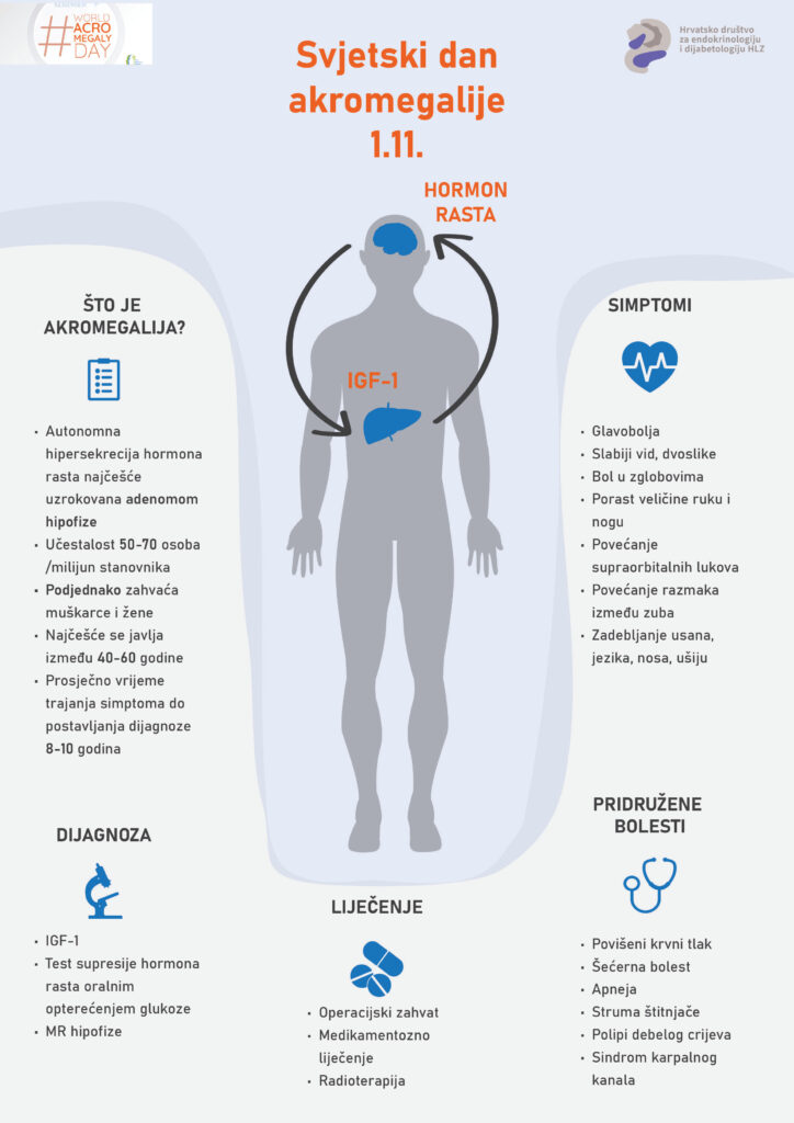Svjetski dan akromegalije: mali znakovi, velike promjene